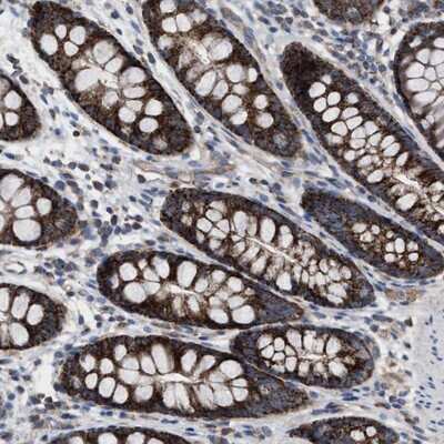 Immunohistochemistry-Paraffin MRM1 Antibody - BSA Free
