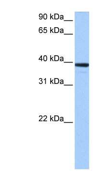 Western Blot: MRM1 Antibody [NBP1-57366] - Human Brain lysate, concentration 0.2-1 ug/ml.