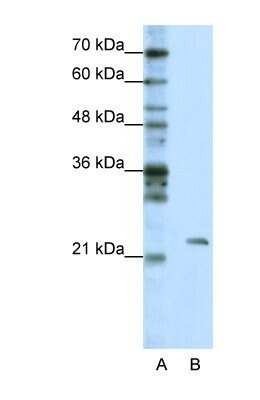 Western Blot MRM1 Antibody - BSA Free