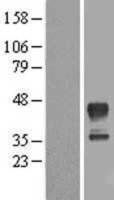 Western Blot: MRM1 Overexpression Lysate (Adult Normal) [NBL1-13230] Left-Empty vector transfected control cell lysate (HEK293 cell lysate); Right -Over-expression Lysate for MRM1.