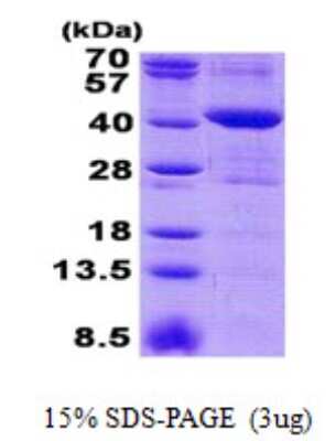 SDS-PAGE Recombinant Human MRM1 His Protein