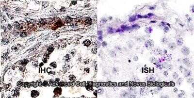 Dual RNAscope ISH-IHC: MRP1 Antibody (IU2H10) - Azide and BSA Free [NBP2-80857] - Formalin-fixed paraffin-embedded tissue sections of human testis were probed for MRP1 mRNA (ACD RNAScope Probe, catalog # 435591; Fast Red chromogen, ACD catalog # 322360). Adjacent tissue section was processed for immunohistochemistry using mouse monoclonal (Novus Biologicals catalog # NB400-156) at 7ug/mL with overnight incubation at 4 degrees Celsius followed by incubation with anti-mouse IgG VisUCyte HRP Polymer Antibody (Catalog # VC001) and DAB chromogen (yellow-brown). Tissue was counterstained with hematoxylin (blue). Specific staining was localized to Leydig cells and seminiferous tubule cells. Image from the standard format of this antibody.