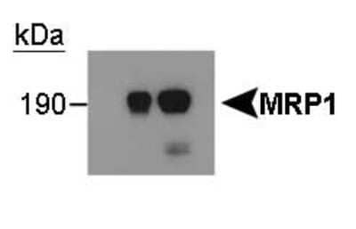 Western Blot: MRP1 Antibody (IU2H10) - Azide and BSA Free [NBP2-80857] - Vector-transfected HEK293 cells 2: MRP1-transfected cells, prep1 3: MRP1-transfected cells, prep2 (the lower band is a degradation product.) Image from the standard format of this antibody.