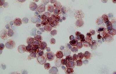 Immunohistochemistry: MRP1 Antibody (MRPm6) [NBP1-42340]