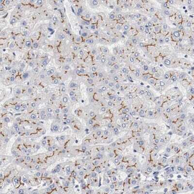 Immunohistochemistry-Paraffin: MRP2 Antibody [NBP1-84434] - Staining of human liver shows high expression.