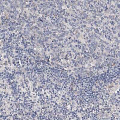 Immunohistochemistry-Paraffin: MRP2 Antibody [NBP1-84434] - Staining of human lymph node shows low expression as expected.