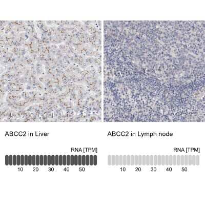 Immunohistochemistry-Paraffin: MRP2 Antibody [NBP1-84434] - Staining in human liver and lymph node tissues using anti-ABCC2 antibody. Corresponding ABCC2 RNA-seq data are presented for the same tissues.
