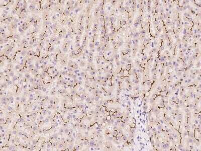 Immunohistochemistry-Paraffin: MRP2 Antibody [NBP2-97774] - Immunochemical staining of human MRP2 in human liver with rabbit polyclonal antibody at 1:500 dilution, formalin-fixed paraffin embedded sections.