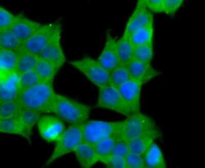 Immunocytochemistry/Immunofluorescence: MRP2 Antibody (JA32-01) [NBP2-66958] - Staining MRP2 in 293T cells (green). The nuclear counter stain is DAPI (blue). Cells were fixed in paraformaldehyde, permeabilised with 0.25% Triton X100/PBS.