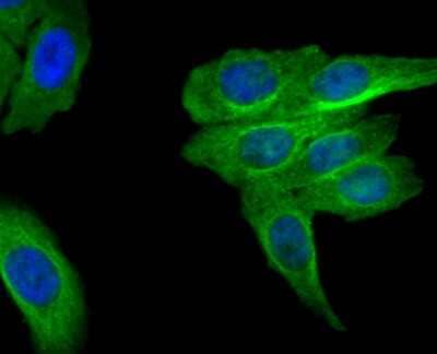 Immunocytochemistry/Immunofluorescence: MRP2 Antibody (JA32-01) [NBP2-66958] - Staining MRP2 in HepG2 cells (green). The nuclear counter stain is DAPI (blue). Cells were fixed in paraformaldehyde, permeabilised with 0.25% Triton X100/PBS.