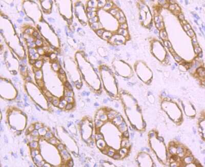 Immunohistochemistry-Paraffin: MRP2 Antibody (JA32-01) [NBP2-66958] - Analysis of paraffin-embedded human kidney tissue using anti-MRP2 antibody. Counter stained with hematoxylin.