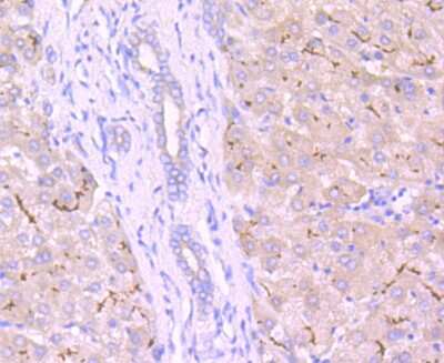 Immunohistochemistry-Paraffin: MRP2 Antibody (JA32-01) [NBP2-66958] - Analysis of paraffin-embedded human liver tissue using anti-MRP2 antibody. Counter stained with hematoxylin.