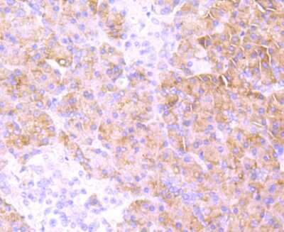 Immunohistochemistry-Paraffin: MRP2 Antibody (JA32-01) [NBP2-66958] - Analysis of paraffin-embedded human pancreas tissue using anti-MRP2 antibody. Counter stained with hematoxylin.