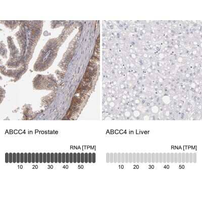 <b>Orthogonal Strategies Validation. </b>Immunohistochemistry-Paraffin: MRP4/ABCC4 Antibody [NBP1-84782] - Analysis in human prostate and liver tissues. Corresponding MRP4/ABCC4 RNA-seq data are presented for the same tissues.