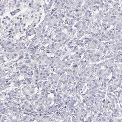 Immunohistochemistry-Paraffin: MRP4/ABCC4 Antibody [NBP1-84782] - Staining of human pancreas shows no positivity in exocrine glandular cells as expected.