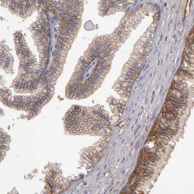 Immunohistochemistry-Paraffin: MRP4/ABCC4 Antibody [NBP1-84782] - Staining of human prostate shows strong membranous positivity in glandular cells.