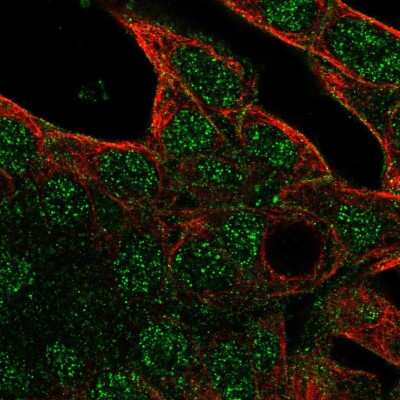 Immunocytochemistry/Immunofluorescence: MRP6 Antibody [NBP2-55262] - Staining of human cell line Hep G2 shows localization to nucleus & plasma membrane.