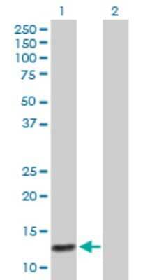 Western Blot: MRP6 Antibody [H00000368-B01P] - Analysis of ABCC6 expression in transfected 293T cell line by ABCC6 polyclonal antibody.  Lane 1: ABCC6 transfected lysate(10.89 KDa). Lane 2: Non-transfected lysate.