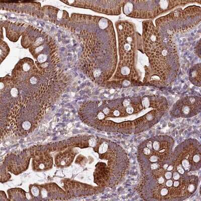 Immunohistochemistry-Paraffin: MRP63 Antibody [NBP1-90898] - Staining of human small intestine shows strong cytoplasmic and membranous positivity in glandular cells.