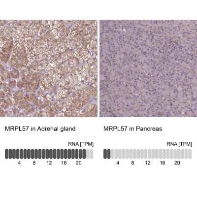 <b>Orthogonal Strategies Validation. </b>Immunohistochemistry-Paraffin: MRP63 Antibody [NBP1-90898] - Staining in human adrenal gland and pancreas tissues using anti-MRPL57 antibody. Corresponding MRPL57 RNA-seq data are presented for the same tissues.
