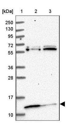 Western Blot: MRP63 Antibody [NBP1-90898] - Lane 1: Marker [kDa] 250, 130, 95, 72, 55, 36, 28, 17, 10Lane 2: Human cell line RT-4Lane 3: Human cell line U-251MG sp