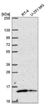 Western Blot: MRP63 Antibody [NBP2-57237] - Western blot analysis in human cell line RT-4 and human cell line U-251 MG.