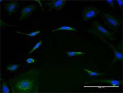 Immunocytochemistry/ Immunofluorescence MRPL1 Antibody (2C4)