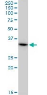 Western Blot: MRPL1 Antibody (2C4) [H00065008-M02] - MRPL1 monoclonal antibody (M02), clone 2C4. Analysis of MRPL1 expression in A-431.