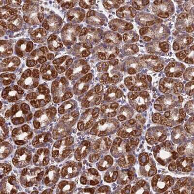Immunohistochemistry-Paraffin: MRPL1 Antibody [NBP2-13609] - Staining of human stomach, upper shows strong cytoplasmic positivity in glandular cells.