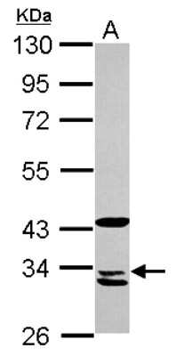 Western Blot: MRPL1 Antibody [NBP2-19394] - Sample (30 ug of whole cell lysate) A: A431 10% SDS PAGE gel, diluted at 1:1000.