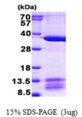 SDS-Page: MRPL1 Protein [NBP2-23239]