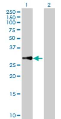 Western Blot: MRPL10 Antibody [H00124995-B01P] - Analysis of MRPL10 expression in transfected 293T cell line by MRPL10 polyclonal antibody.  Lane 1: MRPL10 transfected lysate(28.82 KDa). Lane 2: Non-transfected lysate.