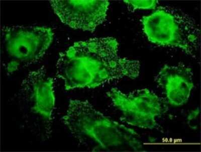 Immunocytochemistry/ Immunofluorescence MRPL12 Antibody (3B12-1A3)