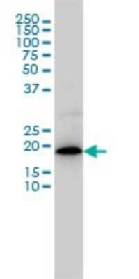 Western Blot: MRPL12 Antibody (3B12-1A3) [H00006182-M01] - MRPL12 monoclonal antibody (M01), clone 3B12-1A3 Analysis of MRPL12 expression in COLO 320 HSR.