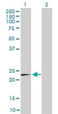 Western Blot MRPL12 Antibody (3B12-1A3)