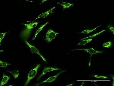 Immunocytochemistry/Immunofluorescence: MRPL12 Antibody [H00006182-D01P] - Analysis of antibody to MRPL12 on HeLa cell. Antibody concentration 10 ug/ml.