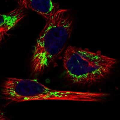 Immunocytochemistry/Immunofluorescence: MRPL12 Antibody [NBP1-85216] - Immunofluorescent staining of human cell line U-251 MG shows localization to mitochondria.