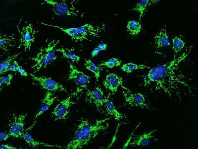 Immunocytochemistry/Immunofluorescence: MRPL12 Antibody [NBP2-97472] - Immunofluorescence staining of MRPL12 in U251MG cells. Cells were fixed with 4% PFA, permeabilzed with 0.1% Triton X-100 in PBS, blocked with 10% serum, and incubated with rabbit anti-Human MRPL12 polyclonal antibody (dilution ratio 1:200) at 4C overnight. Then cells were stained with the Alexa Fluor(R)488-conjugated Goat Anti-rabbit IgG secondary antibody (green) and counterstained with DAPI (blue).Positive staining was localized to Cytoplasm.