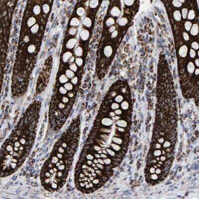 Immunohistochemistry-Paraffin: MRPL12 Antibody [NBP1-85216] - Staining of human colon shows strong cytoplasmic positivity with a granular pattern in glandular cells.