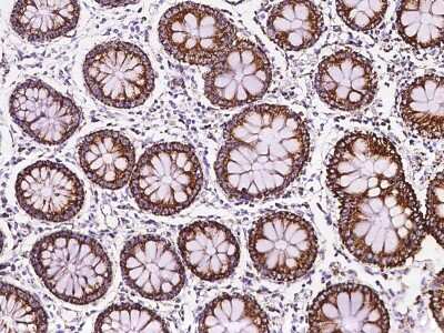 Immunohistochemistry-Paraffin: MRPL12 Antibody [NBP2-97472] - Immunochemical staining of human MRPL12 in human colon with rabbit polyclonal antibody at 1:200 dilution, formalin-fixed paraffin embedded sections.
