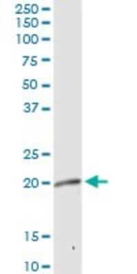 Western Blot: MRPL12 Antibody [H00006182-D01P] - Analysis of MRPL12 expression in human kidney.