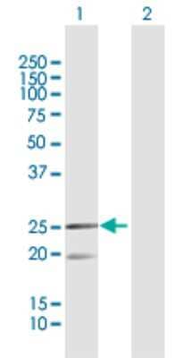 Western Blot: MRPL12 Antibody [H00006182-D01P] - Analysis of MRPL12 expression in transfected 293T cell line by MRPL12 polyclonal antibody.Lane 1: MRPL12 transfected lysate(21.30 KDa).Lane 2: Non-transfected lysate.