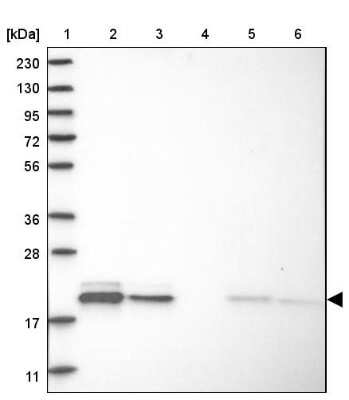 Western Blot: MRPL12 Antibody [NBP1-85216] - Lane 1: Marker  [kDa] 230, 130, 95, 72, 56, 36, 28, 17, 11.  Lane 2: Human cell line RT-4.  Lane 3: Human cell line U-251MG sp.  Lane 4: Human plasma (IgG/HSA depleted).  Lane 5: Human liver tissue.  Lane 6: Human tonsil tissue