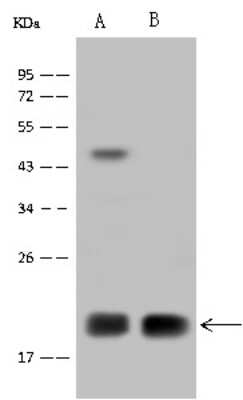 Western Blot: MRPL12 Antibody [NBP2-97472] - Anti-MRPL12 rabbit polyclonal antibody at 1:500 dilution. Lane A: U-251 MG Whole Cell Lysate Lane B: A431 Whole Cell Lysate Lysates/proteins at 30 ug per lane. Secondary Goat Anti-Rabbit IgG (H+L)/HRP at 1/10000 dilution. Developed using the ECL technique. Performed under reducing conditions. Predicted band size: 21 kDa. Observed band size: 21 kDa