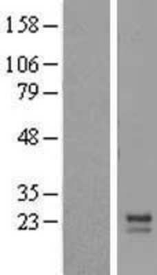 Western Blot: MRPL12 Overexpression Lysate (Adult Normal) [NBL1-13235] Left-Empty vector transfected control cell lysate (HEK293 cell lysate); Right -Over-expression Lysate for MRPL12.