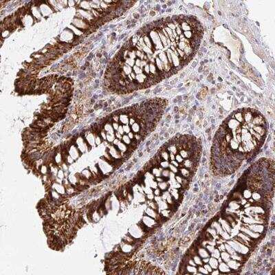 Immunohistochemistry-Paraffin: MRPL13 Antibody [NBP2-32572] - Staining of human colon shows strong cytoplasmic positivity in glandular cells.