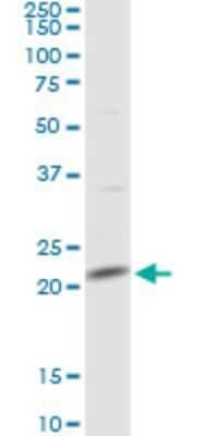 Western Blot: MRPL13 Antibody [H00028998-D01P] - Analysis of MRPL13 expression in human kidney.