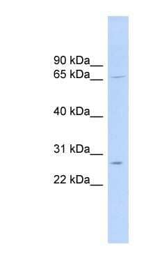 Western Blot: MRPL13 Antibody [NBP1-57600] - 721_B cell lysate, concentration 0.2-1 ug/ml.