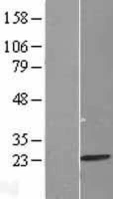 Western Blot MRPL13 Overexpression Lysate