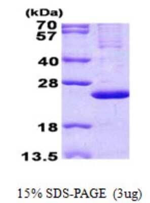 SDS-PAGE Recombinant Human MRPL13 His Protein